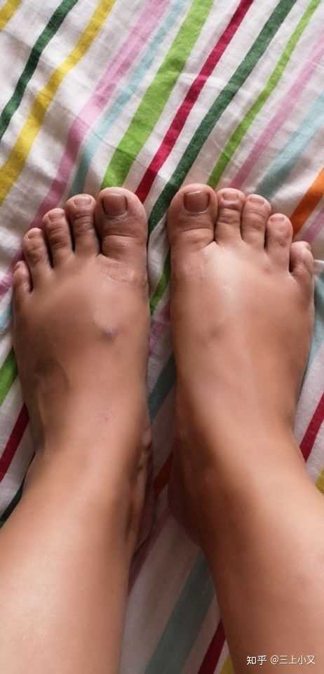 女生脚丑是种什么样的体验?