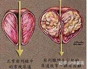 前列腺在人体器官中起到了什么作用