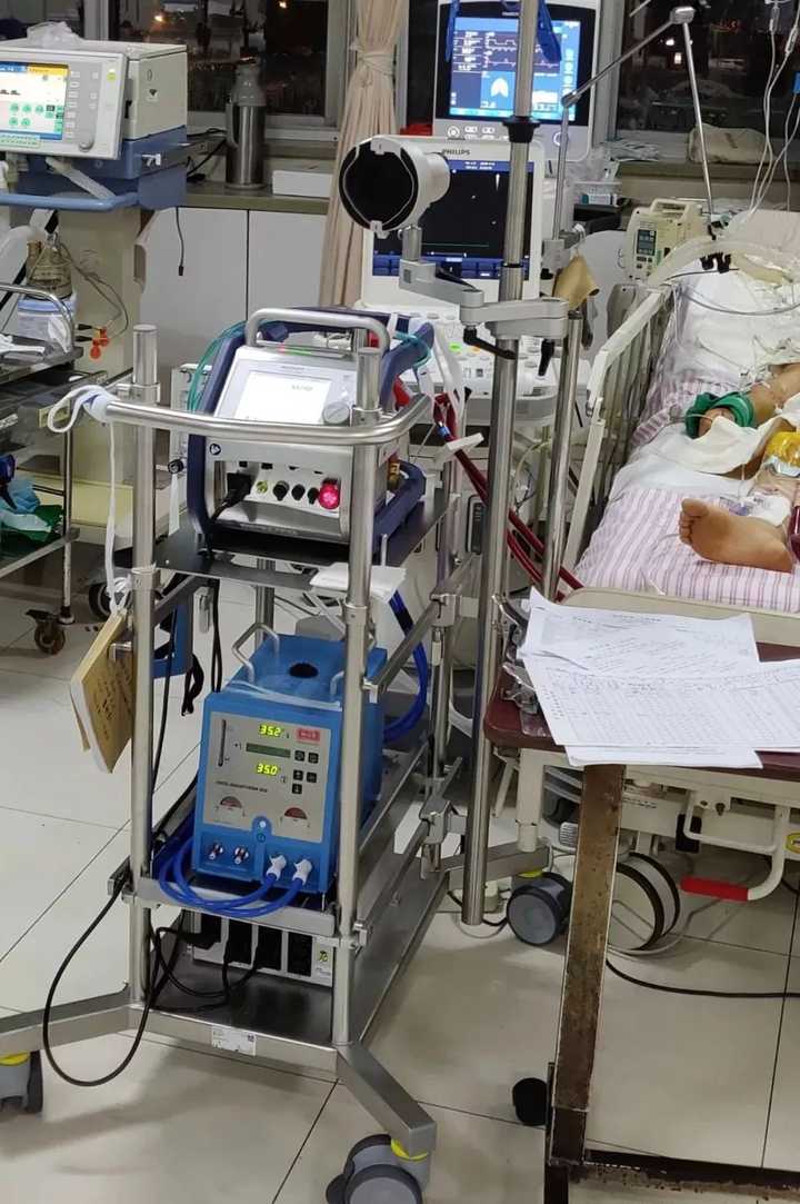 叶克膜(ecmo)是一种什么技术?