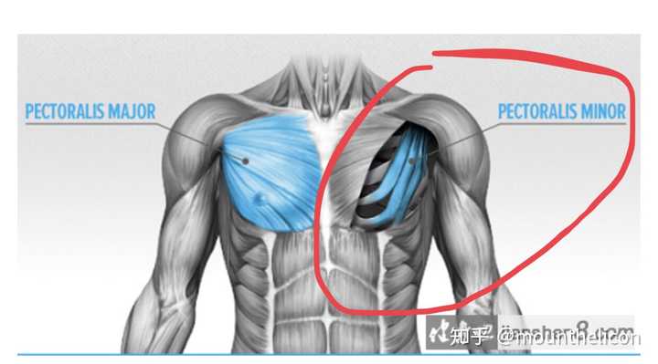 a松解胸小肌 先松解以下胸大肌,一般这个过程比较容易,胸大肌在胸小肌