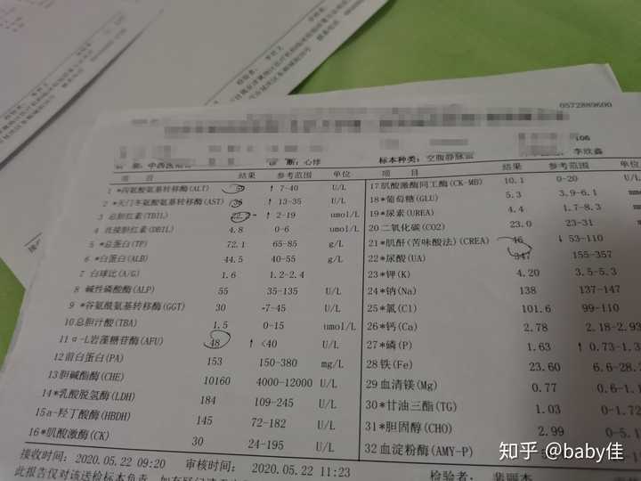 得了甲亢是一种什么样的体验?