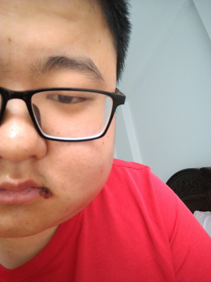 让刚拔完智齿脸肿得像个球的我去哭会!