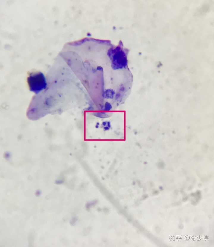 显微镜下的犬小孢子菌