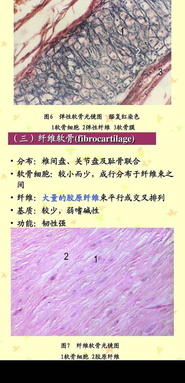 弹性软,透明软骨和纤维软骨的不同本质上是因为什么?