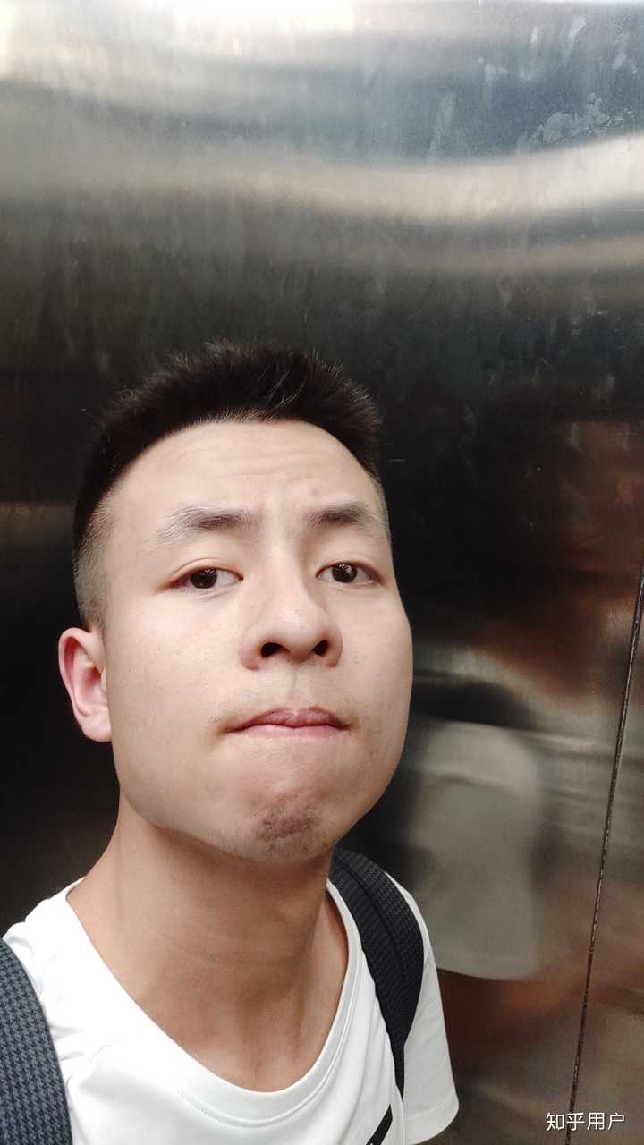单眼失明是种怎样的体验?