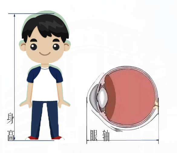请问很多人说的近视(眼轴变长)是不可逆的 是什么意思