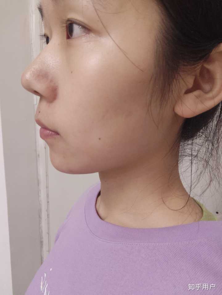 鼻子高但是山根低是什么样?