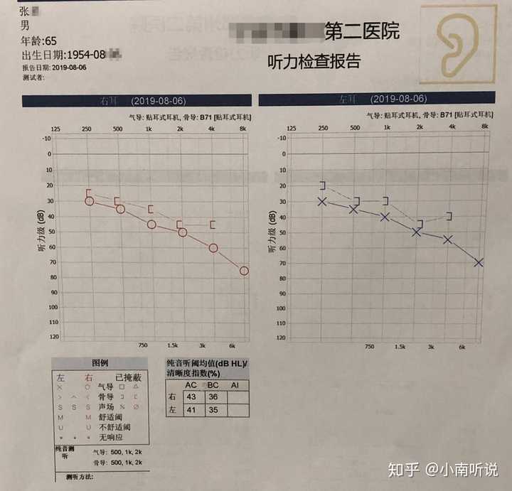 如何看懂听力图?