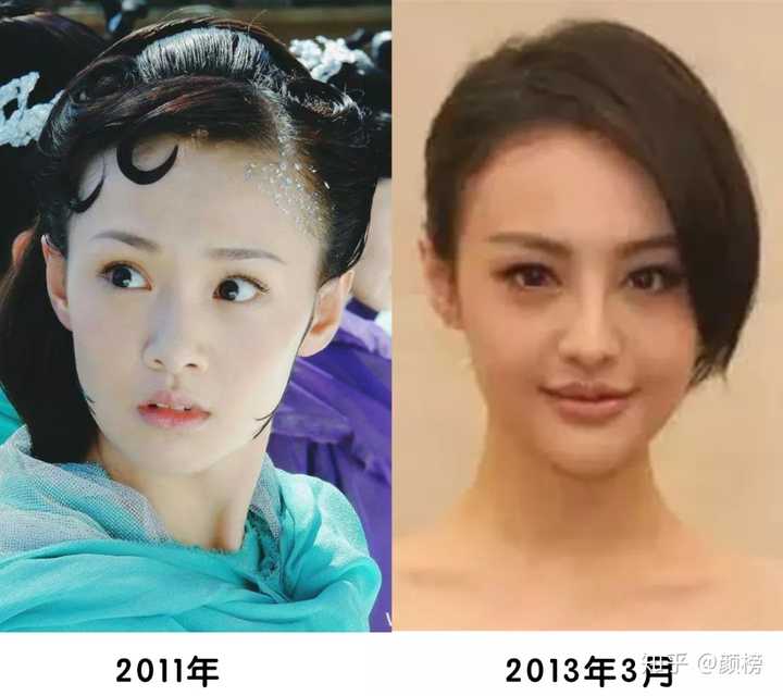 郑爽整容整了哪里?