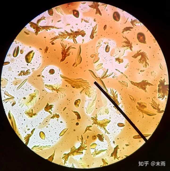 我是五味子 十 五 柽柳又名三眠柳 十 七 大黄粉末加热升华得到的结晶