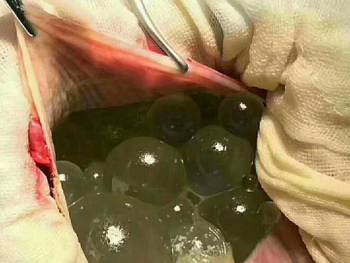 寄生虫病有多可怕?