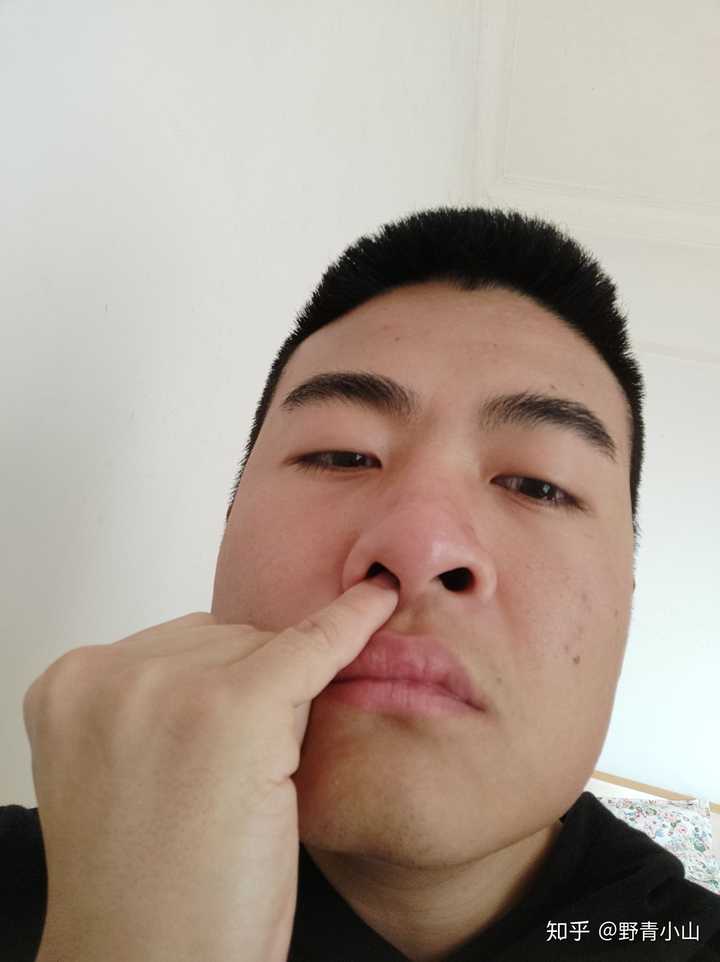鼻孔挖大了怎么办,还能恢复吗?