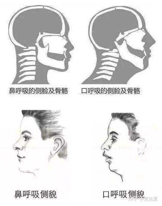 通过嘴跟通过鼻子呼吸,脸颊,舌头,下巴的位置不同.