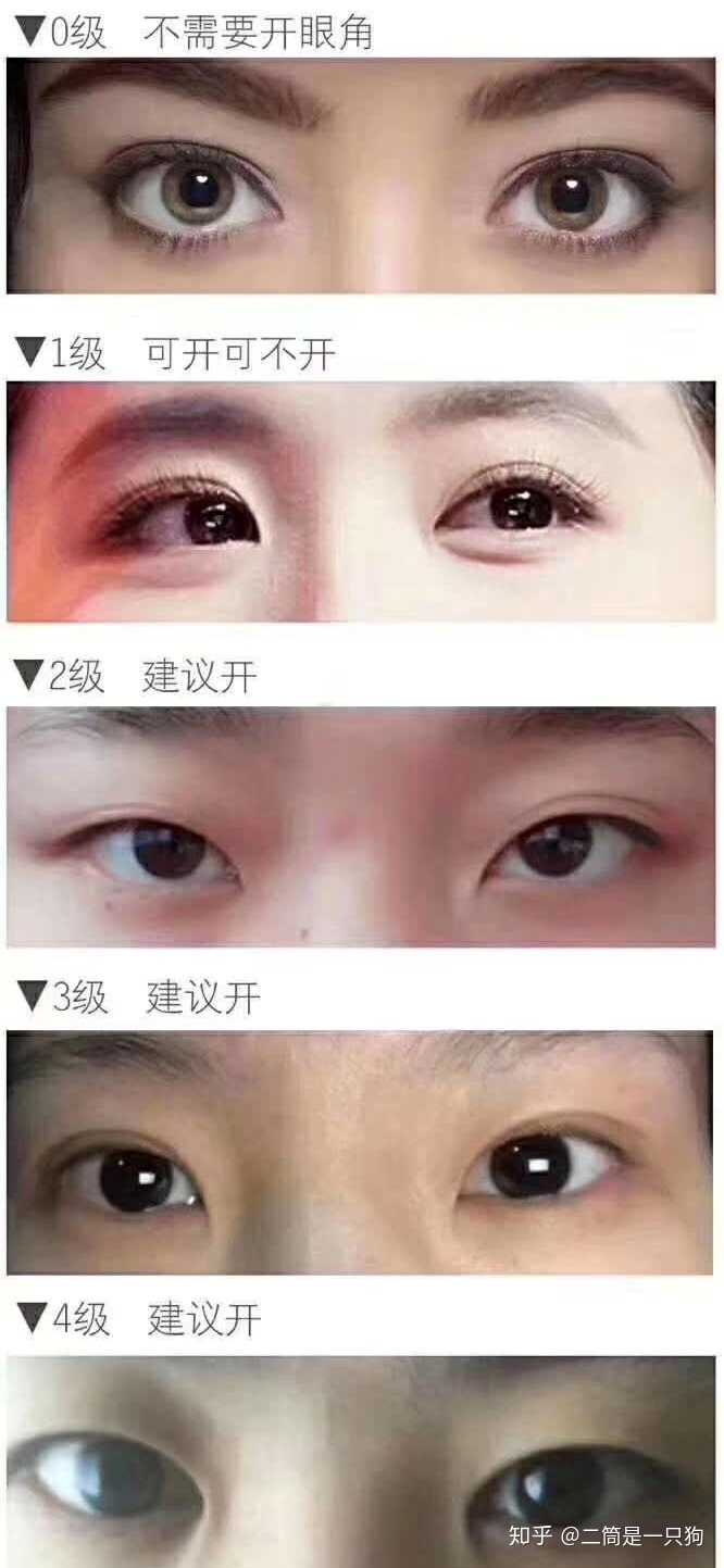 看完你们就自行判断自己是否需要开内眼角咯