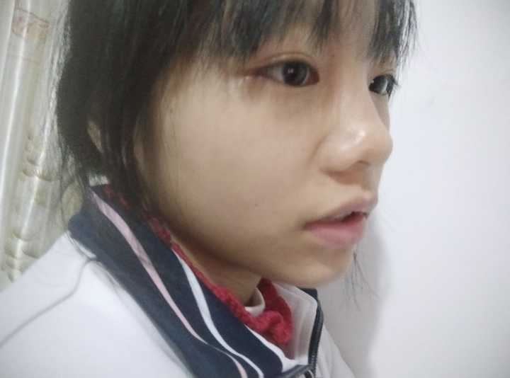 没有鼻梁,鼻子塌的人是什么体验?