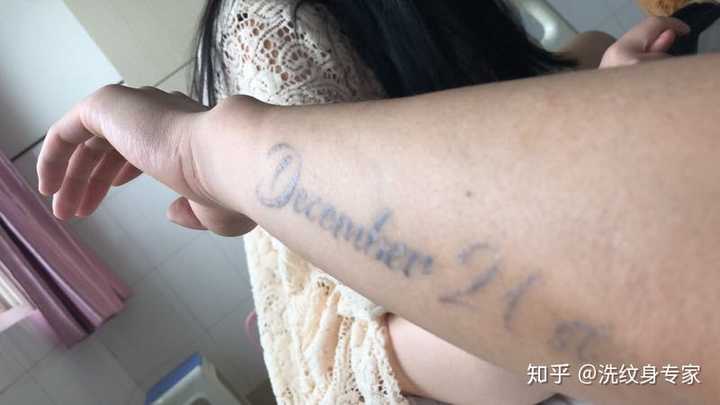 纹身能洗掉吗?