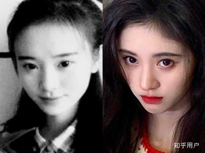 鞠婧祎真的整容了吗?