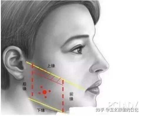 这是我回答关于 婴儿肥,下颌骨,咬肌的详细分析和解决方法.