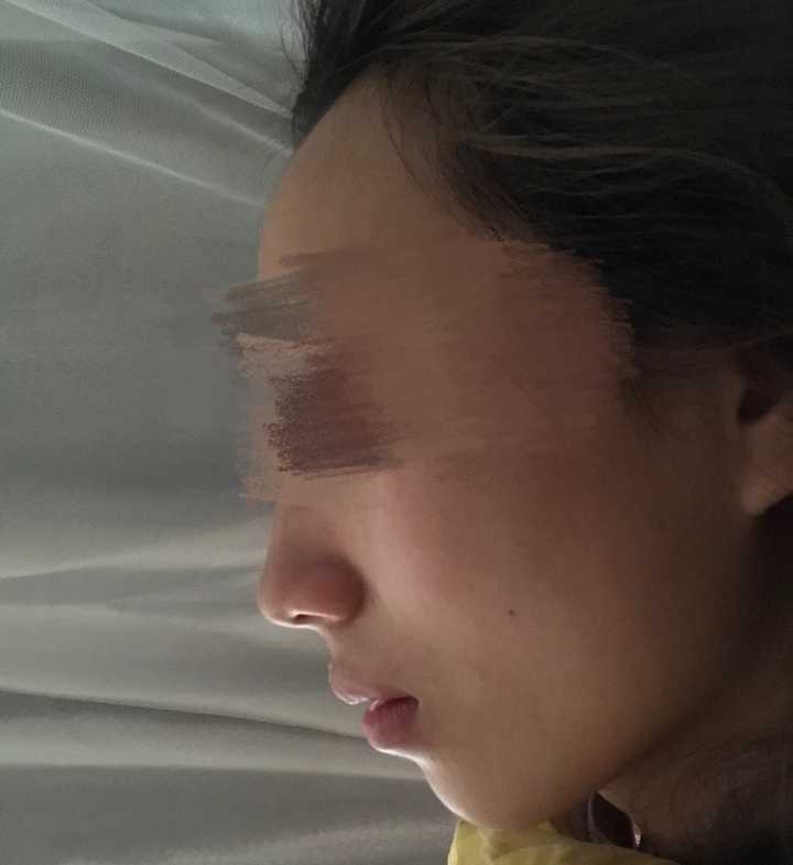 脸正面好看侧面不好看是一种怎样的体验?