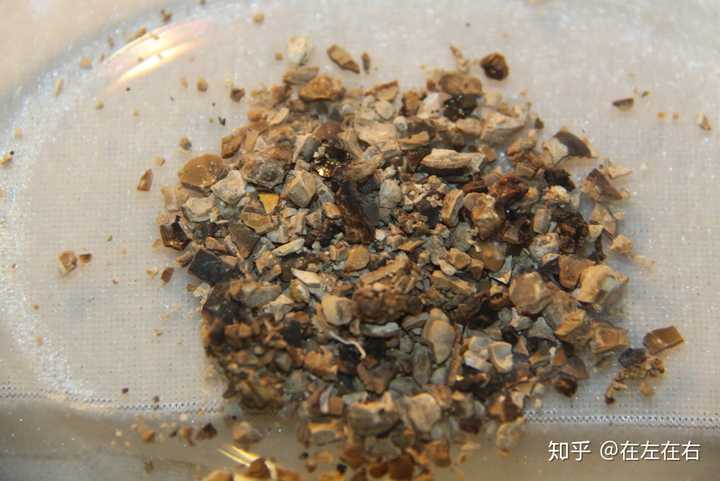 肾结石是一种什么体验?