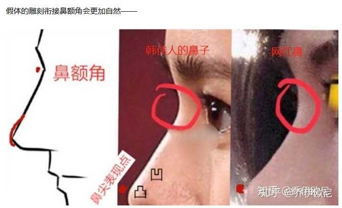 擅长: 朝天短鼻,鞍鼻.特别是露鼻孔的鼻翼缘修补十分擅长.