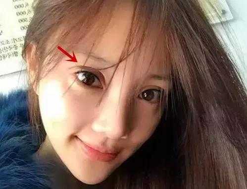 为什么单眼皮的女生都想拥有双眼皮?