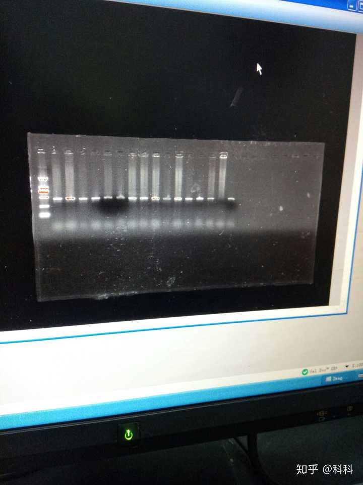 dna琼脂糖凝胶电泳图谱分析