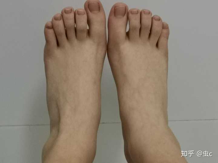 女生有一双很丑的脚有什么体验