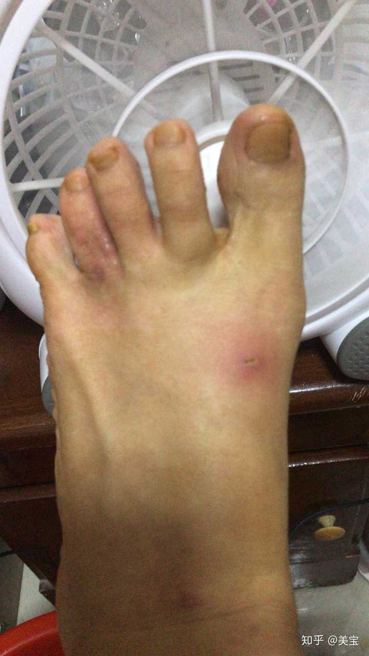 左脚  