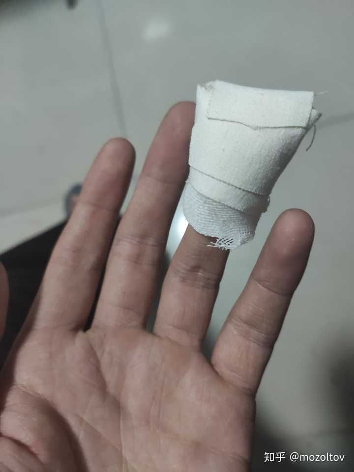 平时手指被割伤应该怎么处理?
