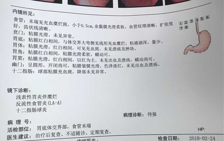 去年就做了一次检查,当时做的就是普通的验血,医生说是肠胃痉挛,开了