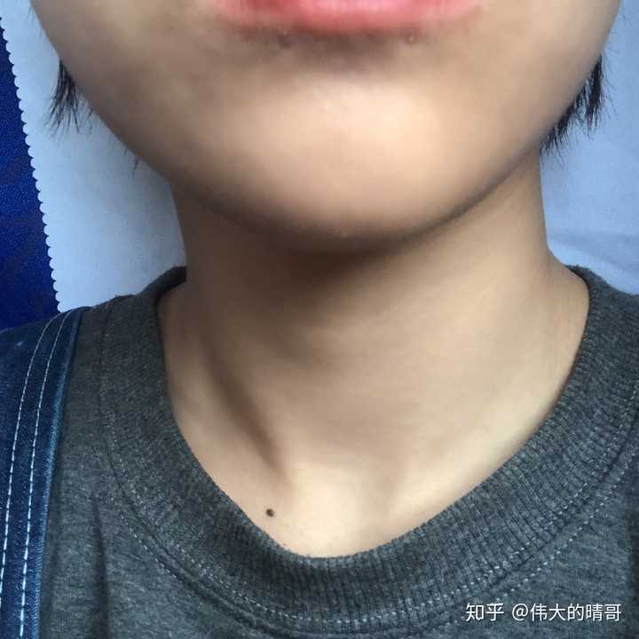 我想看看唇钉摘下后是什么样子的?