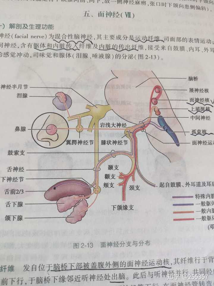 右侧面瘫:额纹对称,闭目有力,排除中枢性面瘫,考虑右侧面神经核(负责