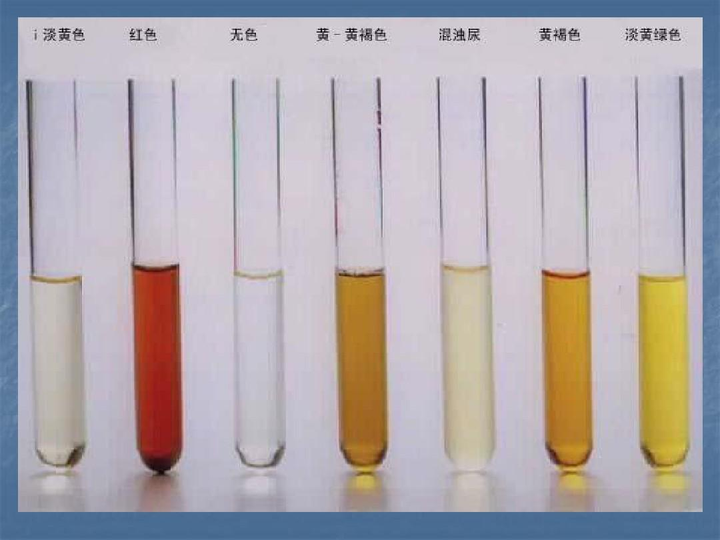 不同尿液颜色的对比