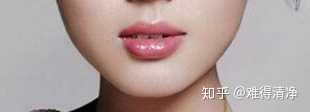 上唇表面: 人中,唇缘弓,唇珠. 下唇表面形态变化小,结构也简单.