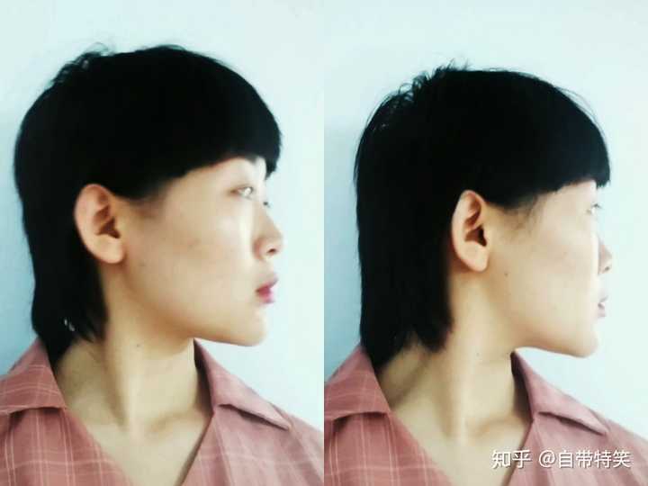 侧脸丑而正脸好看是一种什么体验?