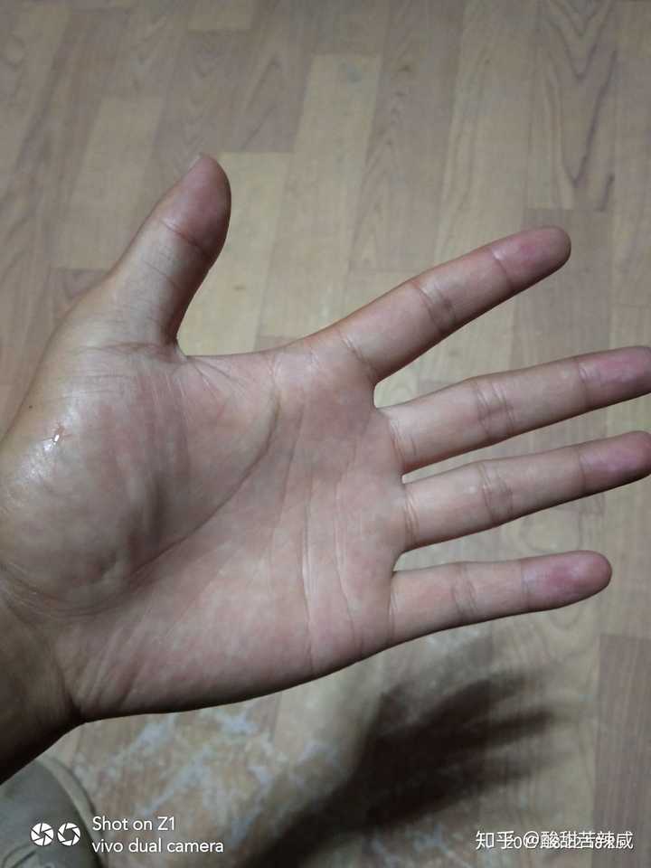 工地十天,手心和手背的对比.