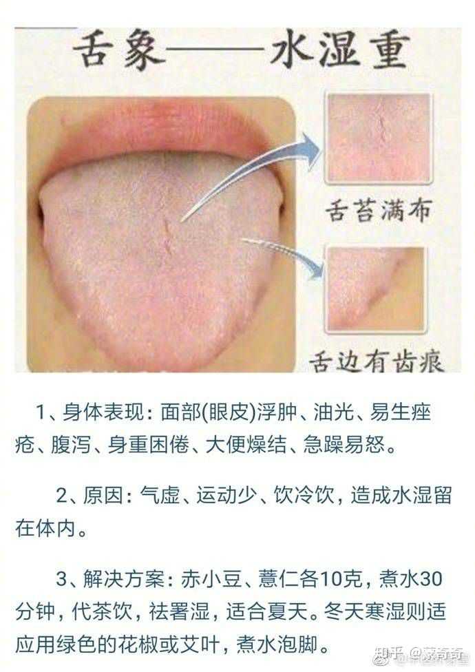 吃薏米吃多久才可以去湿气?