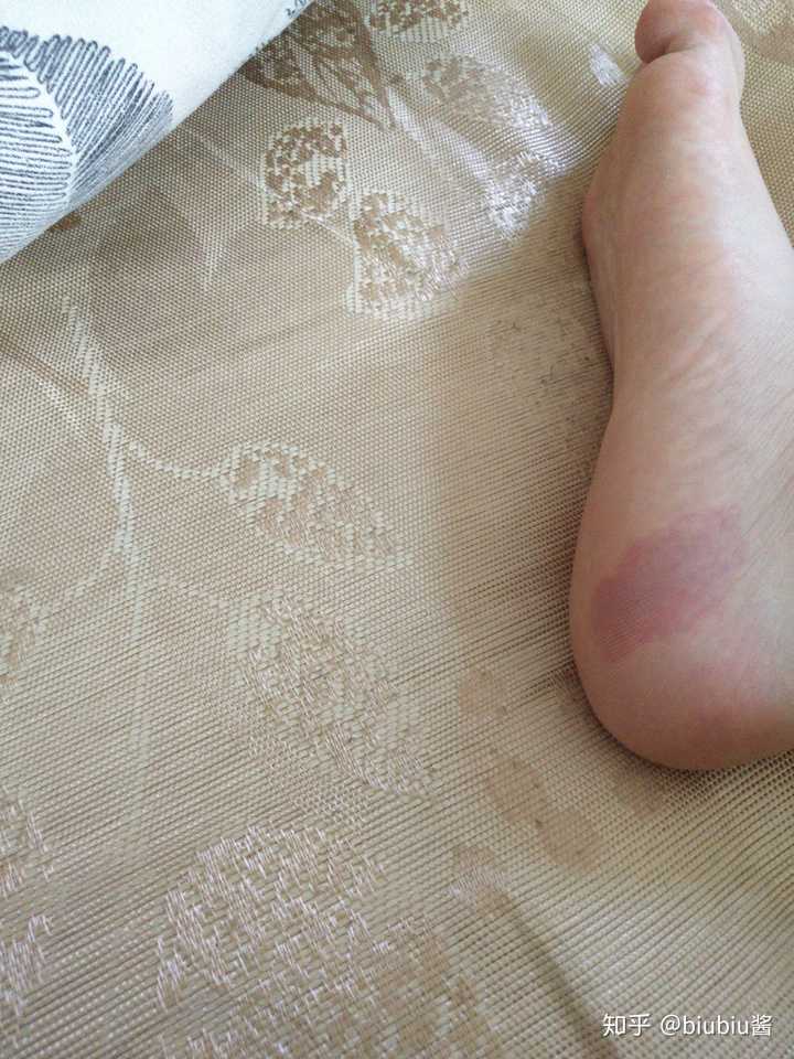 你见过什么特殊的胎记?