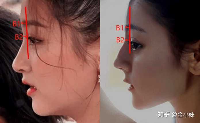 如何拥有一张好看的侧脸?