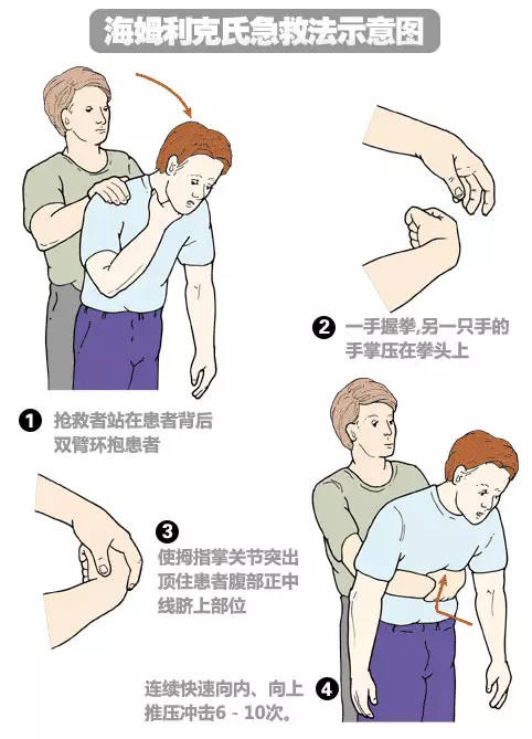 宝宝噎食窒息应该怎么办有哪些急救的办法