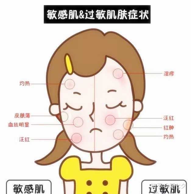 如何修复敏感肌过敏肌