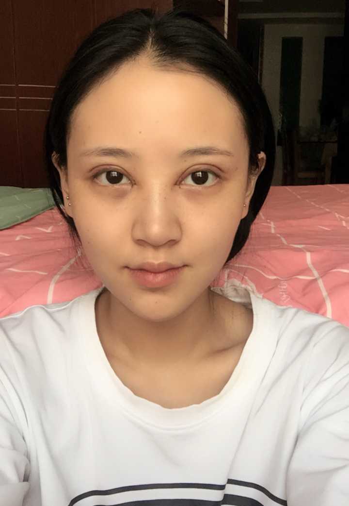 割双眼皮有什么危险吗?