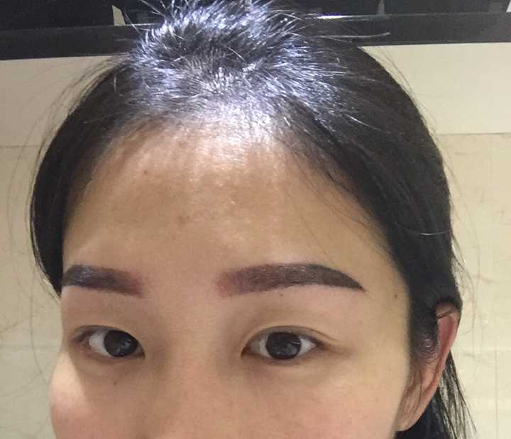 韩式半永久纹眉的恢复过程是怎样的?