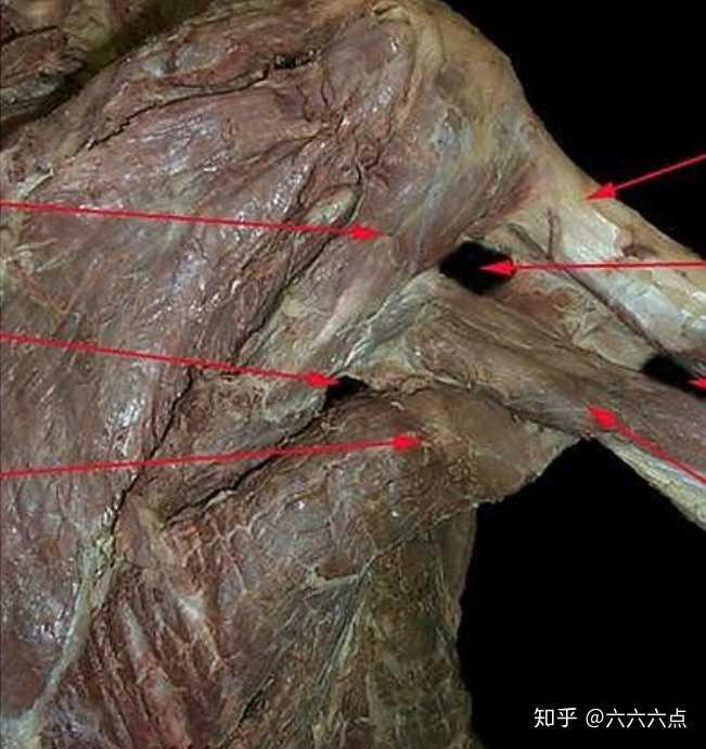 肩部解剖(福尔马林泡)