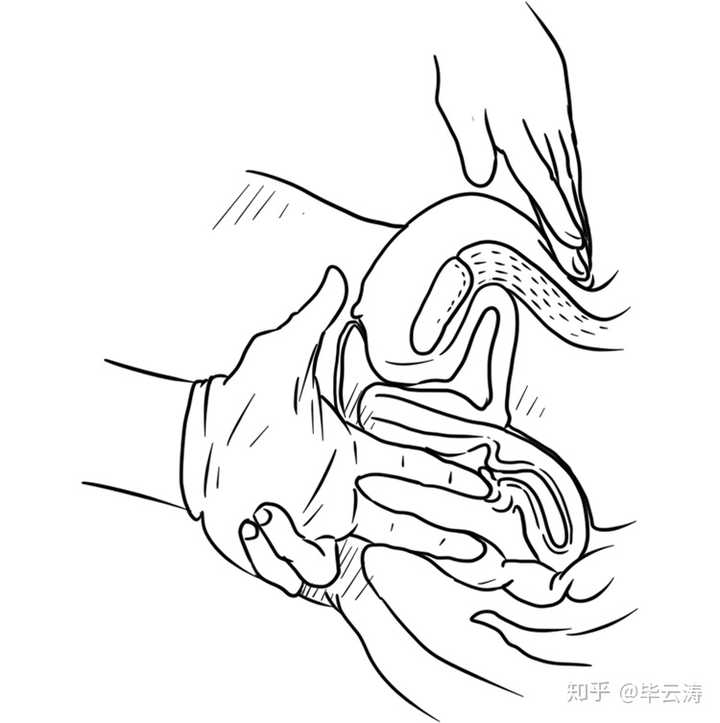 三合诊