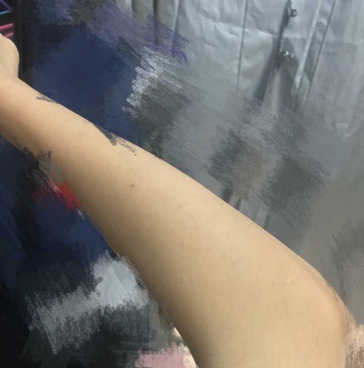 女生怎么解决手臂多毛?