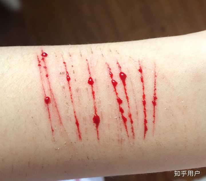 【抑郁症走出笔记】你愿意加入一起写吗?