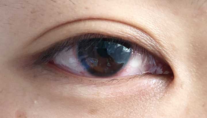 戴隐形眼镜对眼睛有什么危害吗?