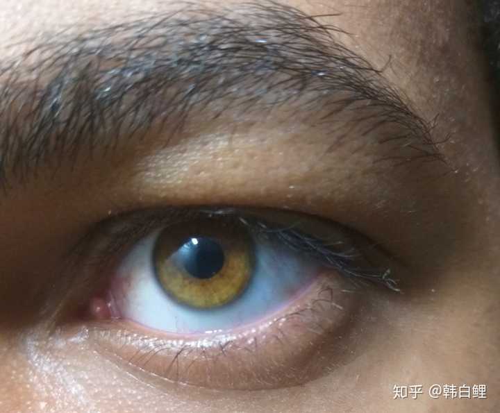 最独特的眼睛颜色是什么